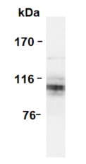 Western blotting image of APP Ab