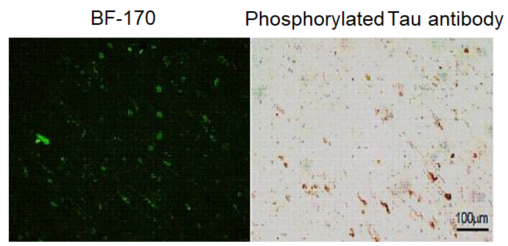 Staining image of neurofibrillary tangles with fluorescent probe BF-170