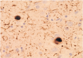 Immunostaining image of α-Synuclein Antibody