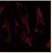 Immunostaining image of  LC3 antibody