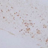 Anti Phosphorylated Tau T181, Rat Monoclonal Antibody (2E2-A6)
