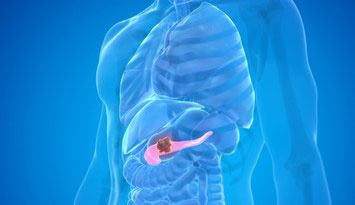 膵臓オルガノイド