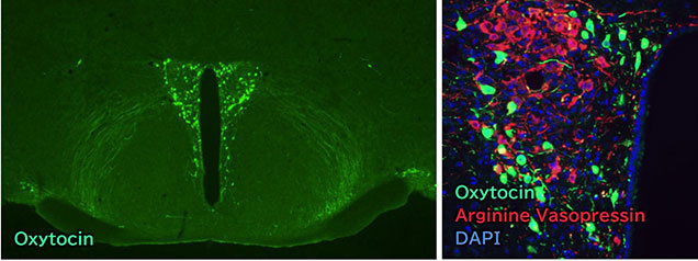 Immunohistochemistry