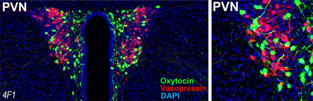 Immunohistochemistry
