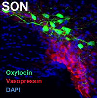Immunohistochemistry