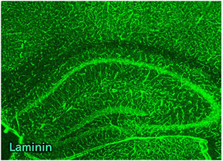 Immunohistochemistry
