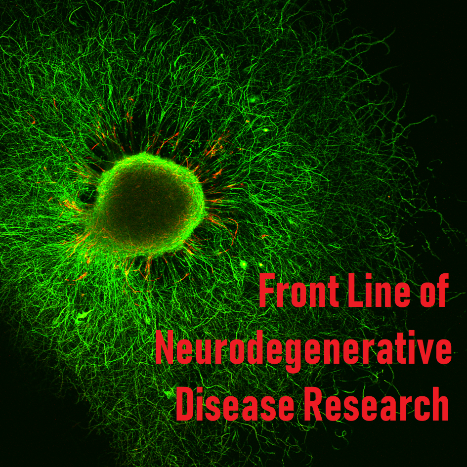 Vol. 2. Tau protein in Alzheimer's disease